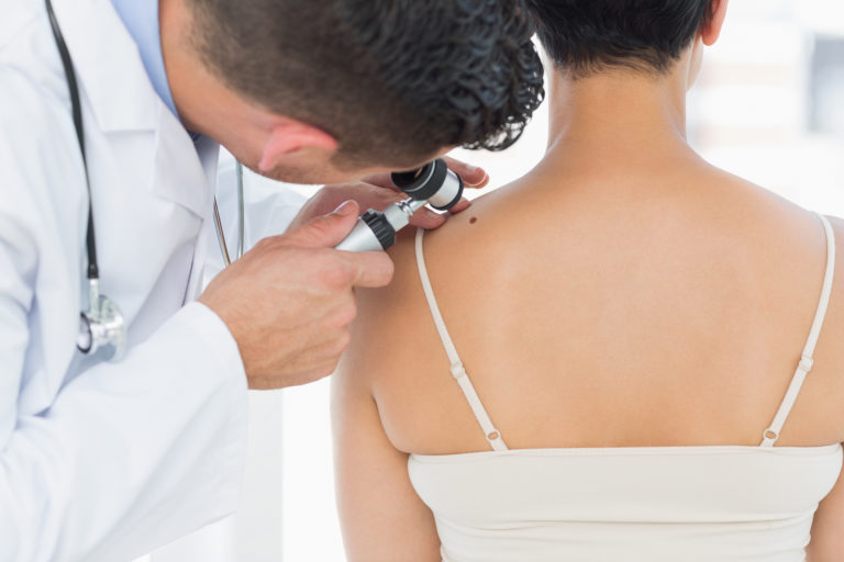 male-dermatologist-examining-mole-on-back-of-woman-in-clinic-aw